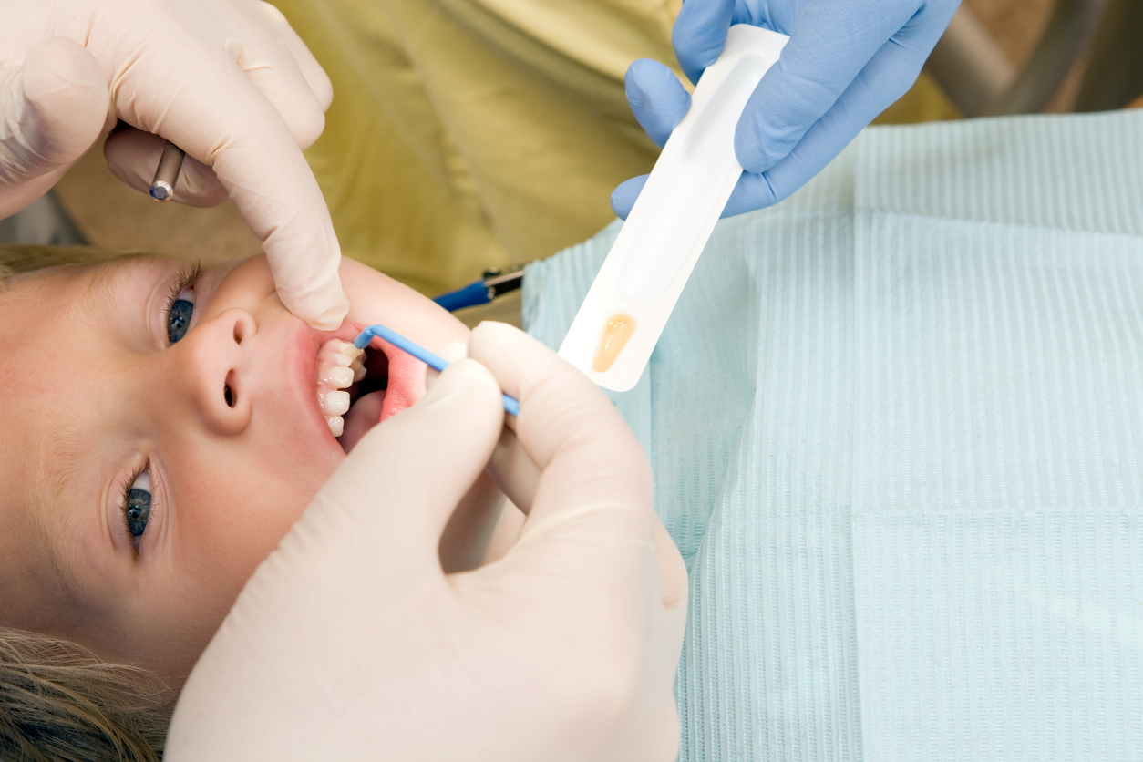 Child Boy Receiving Fluoride Treatment from Dentist